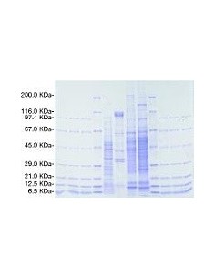 SERVAGel™ Neutral pH 7.4, 10 pack