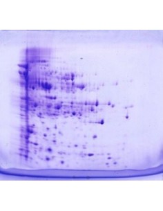 SERVAGel™ TG 14 LS Precast Gels, 10 pack, 10 x 10cm 2