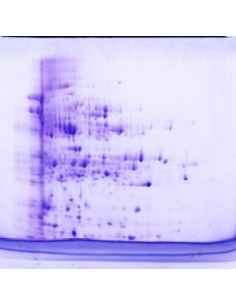 SERVAGel™ TG 12 LS precast Gel, 10 pack, 10 x 10cm 2