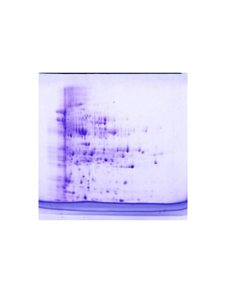 SERVAGel™ TG 12 LS precast Gel, 10 pack, 10 x 10cm