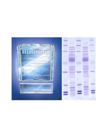 Precast Gels 4 - 20 % gradient gel