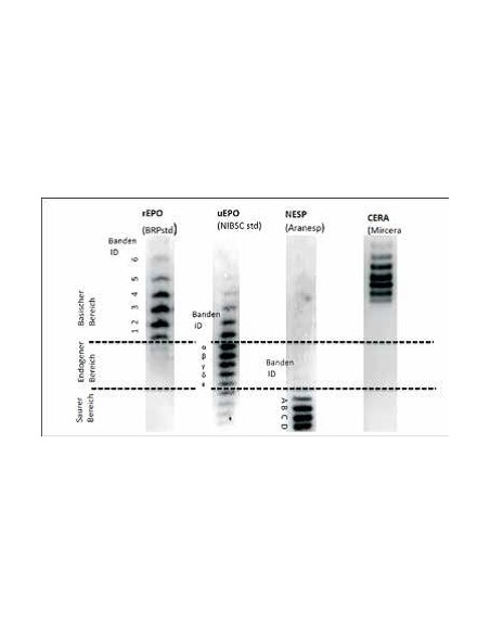Isoelectric Focusing EPO Test Kit