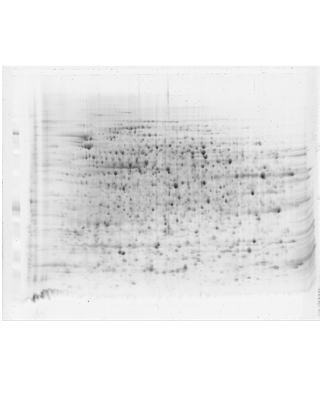 FocusGel 3-10