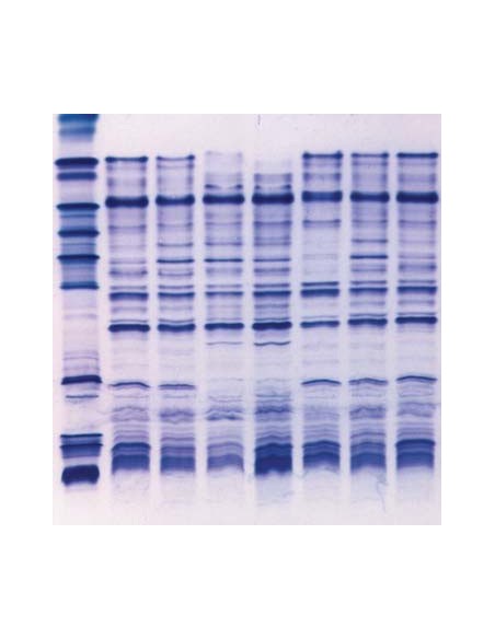 SERVALYT™ PRECOTES™, pH 4-6 Horizontal IEF Gels, 5 pack, 125 x 125mm