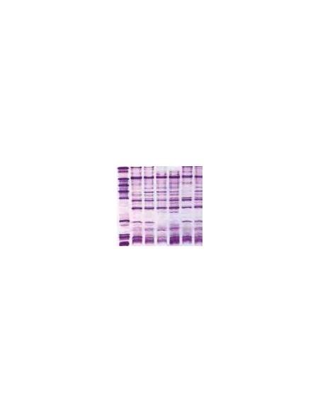 SERVALYT™ PreNets™, pH 4-6 Horizontal IEF Gels, 5 pack, 125 x 125mm, .03mm