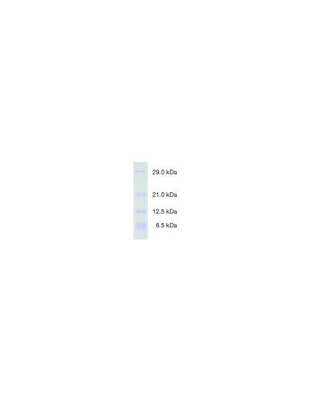 Protein Test Mixture 5 for SDS PAGE