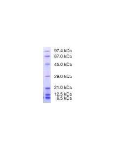 Protein Test Mixture 6 for SDS PAGE